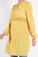 Tesettür giyim SARI ALVİNA PÜSKÜL DETAYLI TUNİK 4470